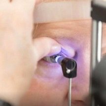 Inteligência artificial pode se tornar aliada no combate ao glaucoma - CBO/Divulgação