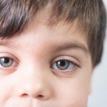 Reflexo branco nos olhos: entenda condição que assusta pais - Freepik