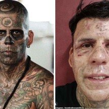 Homem revela rosto após dolorosa remoção de 170 tatuagens - Reprodução / redes sociais