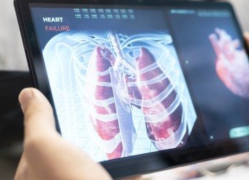 Diagnóstico precoce e um time multidisciplinar, incluindo pneumologista, cirurgião, oncologista e outros, são essenciais no tratamento do câncer de pulmão
     -  (crédito: Dragos Condrea/Freepik)