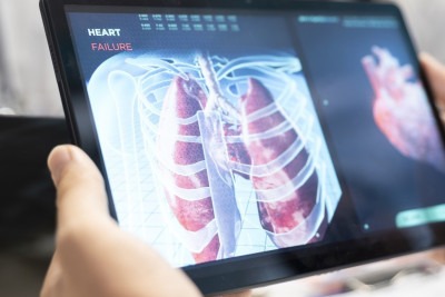 Diagnóstico precoce e um time multidisciplinar, incluindo pneumologista, cirurgião, oncologista e outros, são essenciais no tratamento do câncer de pulmão
     -  (crédito: Dragos Condrea/Freepik)