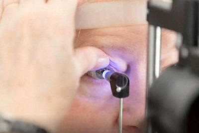 Uso da inteligência artificial na prevenção e no controle do glaucoma permanece em fase de estudo -  (crédito: CBO/Divulgação)
