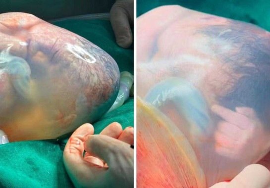  Hospital Marieta Konder Bornhausen