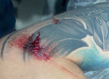 Homem estava embriagado e disse que parou para urinar, quando foi agredido -  (crédito: PMMG)