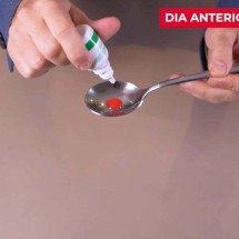 Colonoscopia: preparo inadequado impede identificação de lesões cancerosas? - Santa casa BH
