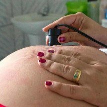 Assistência ao parto avança no Brasil, mas pré-natal ainda preocupa - Arquivo/MDS