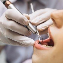 Dentista e clínica deverão indenizar em R$7,5 mil paciente que perdeu dente - Reprodução / Redes Sociais