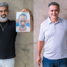 Transplante capilar em BH: onde fazer o procedimento que virou tendência  - Divulgação Clinica Rejuvenesce