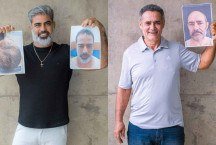 Transplante capilar em BH: onde fazer o procedimento que virou tendência 
