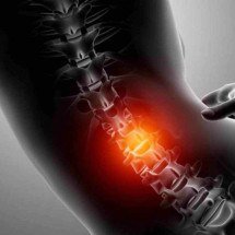 Polilaminina: pesquisa avança e 5 voluntários devem receber a substância - Freepik