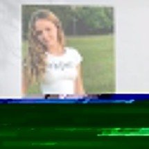 Pra quem não viu: Caso com desfecho trágico ligou alerta sobre extração do siso - REPRODUÇÃO DE VÍDEO G1