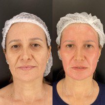 Mercado de medicina estética cresce e ganha força em Minas Gerais - Reprodução Instagram