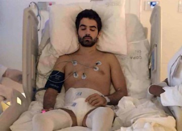 Após sofrer lesão cervical em acidente de carro, o bancário Bruno Drummond de Freitas se voluntariou a participar dos estudos e agora comemora a evolução

 -  (crédito: Comunicação CFF/Reprodução)