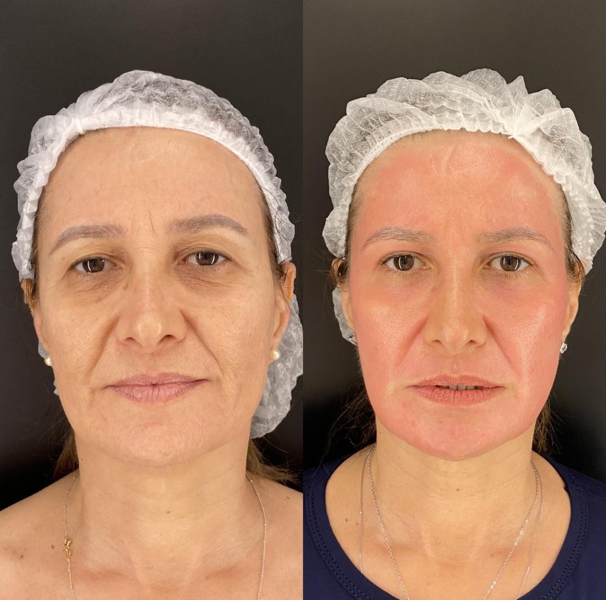 Mercado de medicina estética cresce e ganha força em Minas Gerais

 -  (crédito: Reprodução Instagram)