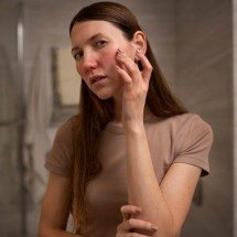 Entenda alterações na pele que podem ser sinais silenciosos de doenças - Freepik