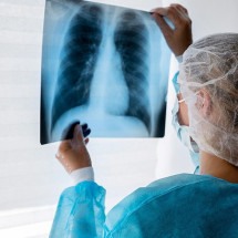 INCA prevê 32 mil casos de câncer de pulmão no País em 2025 - Freepik
