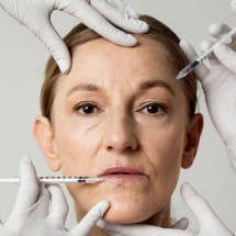 Rejuvenescimento de mãos - Freepik