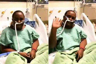 Pra quem não viu: Tumor raro muda cor de pele e causa briga judicial