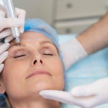 Por que a blefaroplastia é a cirurgia estética mais realizada no mundo - Freepik