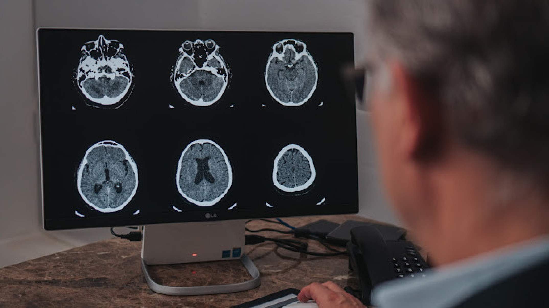 Setembro é o mês de conscientização do aneurisma cerebral  -  Vinny Campos