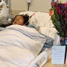 Mulher tem pernas e braços amputados após ataque de pitbull - GoFundMe