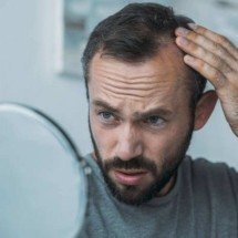 Calvície masculina: conheça as causas da queda de cabelo e os tratamentos - Rede LB