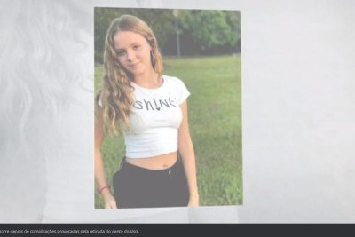 A morte de uma jovem de 18 anos em decorrência de infecções provocadas pela retirada dos dentes do siso, no interior de São Paulo,causou perplexidade. O FLIPAR mostrou e republica para quem não viu.  -  (crédito: REPRODUÇÃO DE VÍDEO G1)