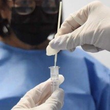 COVID-19 causou metade das mortes por vírus respiratórios em 4 semanas