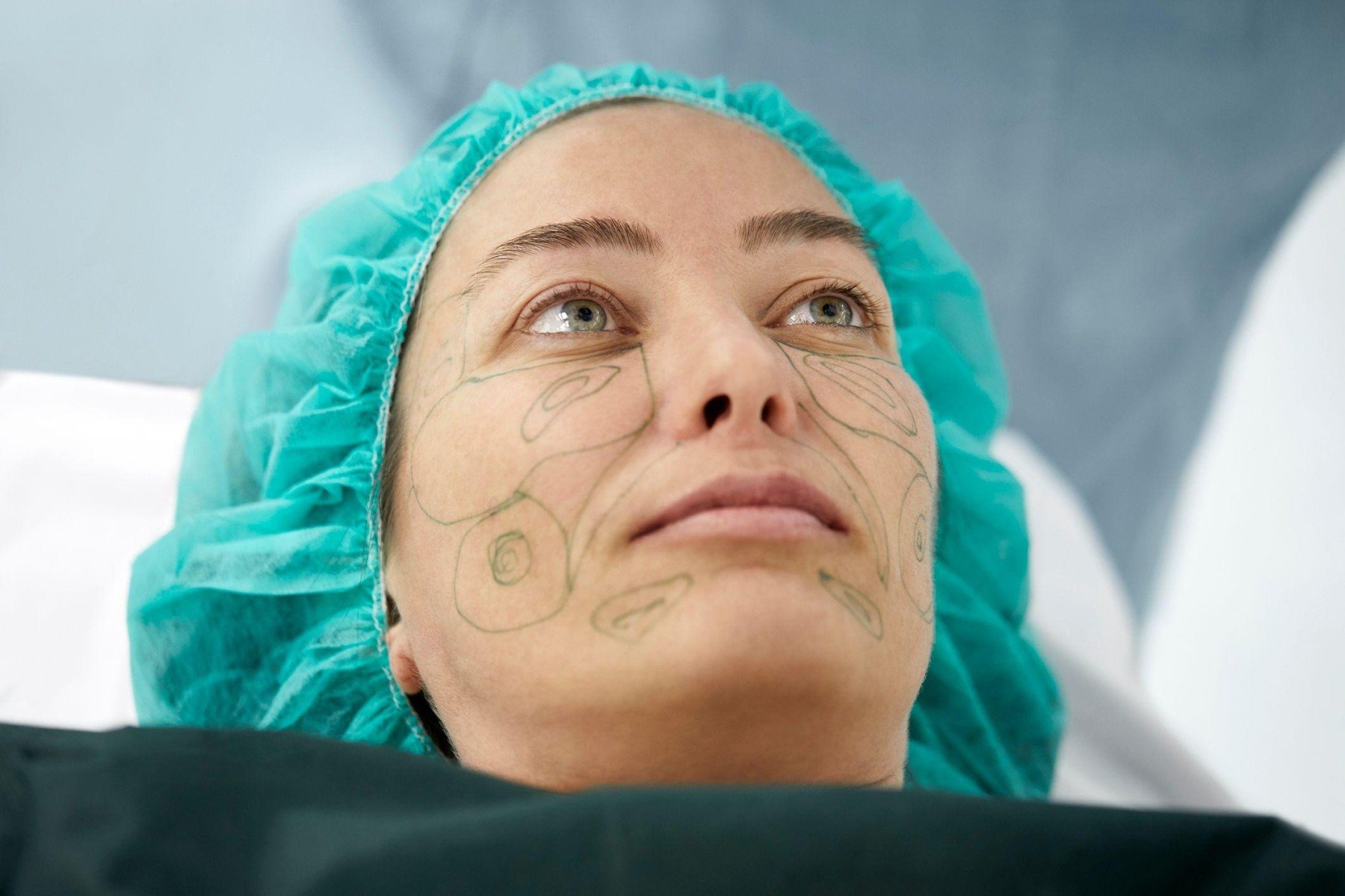 Lifting facial aos 28? Por que jovens estão recorrendo a cirurgias plásticas no rosto - Julia Gilando