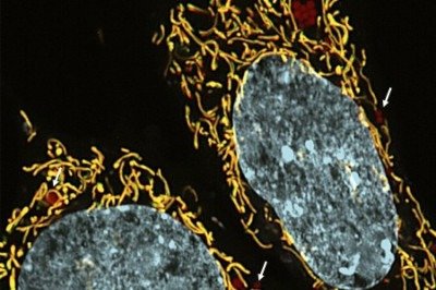 Células de fibroblasto fetal contendo mutação em gene do DNA mitocondrial: tratadas com um inibidor, a condição foi revertida -  (crédito:  Marcos Chiaratti/DGE-UFSCar)