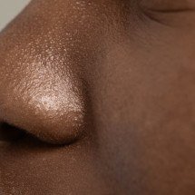 Pele lisa e uniforme: é possível fechar os poros? Isso é mesmo necessário? - Freepik