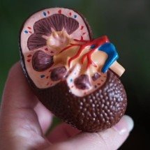 Cuidados com os rins que podem evitar doenças graves - averey/Unsplash