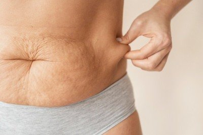 Mesmo com novas tÃ©cnicas, hÃ¡bitos saudÃ¡veis ainda sÃ£o fundamentais para preservar o colÃ¡geno natural da pele -  (crédito: FreePik)