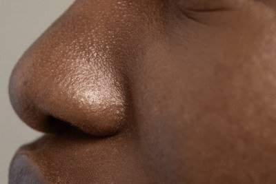Pele saudável não significa pele sem poros, mas sim uma pele bem cuidada, respeitando suas características naturais -  (crédito: Freepik)