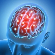 Por que o sedentarismo leva ao AVC; atividade física diminui risco em 33% - Freepik