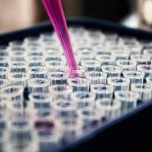 Pesquisas brasileiras avançam no diagnóstico de Alzheimer -  Louis Reed/ Unsplash