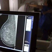 Outubro Rosa: como receber o auxílio-doença em tratamento de câncer - Jos&eacute; Cruz/Ag&ecirc;ncia Brasil