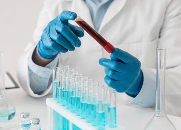 Existem testes rápidos e análises laboratoriais que detectam anticorpos produzidos contra a bactéria -  (crédito: FreePik)