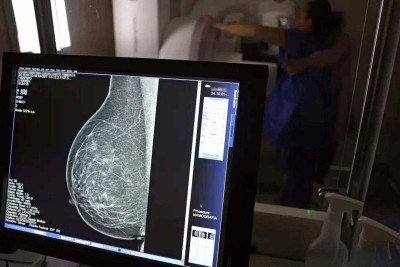 Inca estimou 73.610 novos casos de c&acirc;ncer de mama este ano no pa&iacute;s -  (crédito: Jos&eacute; Cruz/Ag&ecirc;ncia Brasil)