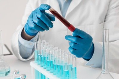 Existem testes rápidos e análises laboratoriais que detectam anticorpos produzidos contra a bactéria -  (crédito: FreePik)