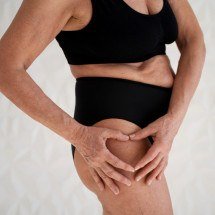 Excesso de peso pode causar sobrecarga nos quadris - FreePik