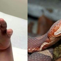 Funcionários de creche confundem picada de cobra com farpa e atrasam socorro a aluno - Reprodução de redes sociais 