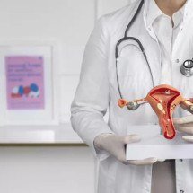 Miomas uterinos: saiba quais as possíveis sequelas desses tumores benignos - Freepik