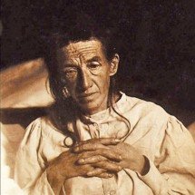 Alerta sobre Mal de Alzheimer: em 2050, mundo deve ter 139 milhões de pessoas com a doença - Domínio público 