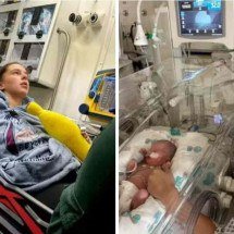 Mulher achou que tinha apendicite, mas descobriu que era trabalho de parto - Reprodução