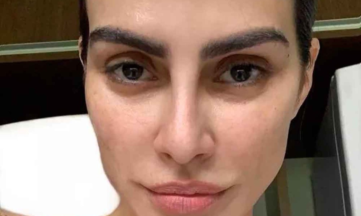 Atriz Cleo Pires tem melasma e deu dicas de tratamento nas redes sociais
- (crédito: Reprodução) Atriz Cleo Pires tem melasma e deu dicas de tratamento nas redes sociais
- (crédito: Reprodução)