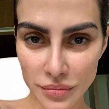 Como prevenir o melasma nesta época de calor - Reprodução