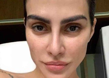 Atriz Cleo Pires tem melasma e deu dicas de tratamento nas redes sociais
 -  (crédito: Reprodução)