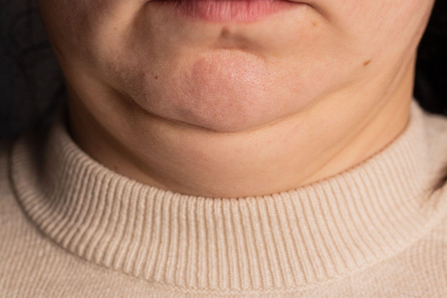 Um pescoço mais fino do que o normal pode ser um sinal de anemia -  (crédito: Getty Images)