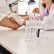 Hospital oferece exames gratuitos contra câncer de mama e de próstata - Freepik